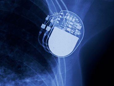 Superior Tube supplies high specification tubing for Cardiac Rhythm Management (CRM) devices