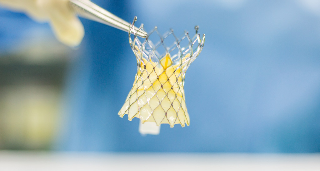 Implantable heart valve tubes